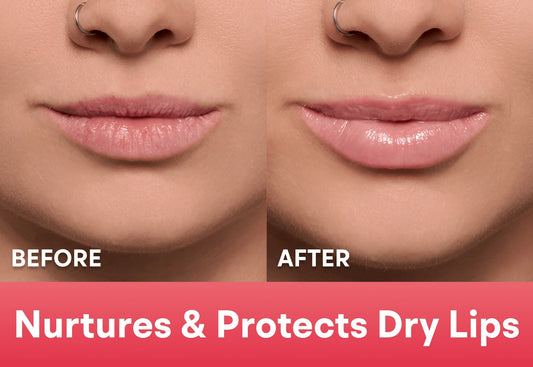 Rose - Limited Edition